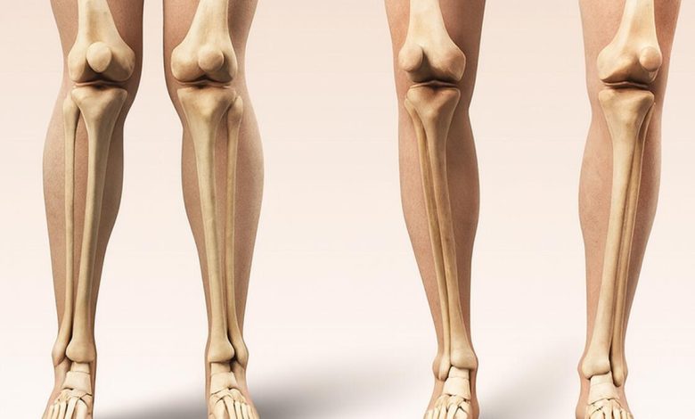 Seus joelhos estão alinhados Veja o que o formato das suas pernas pode revelar