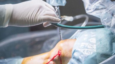 Sutura do menisco quando ela é indicada