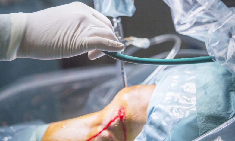 Sutura do menisco quando ela é indicada